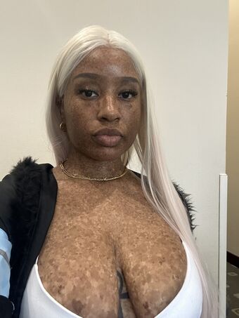 freckledn
