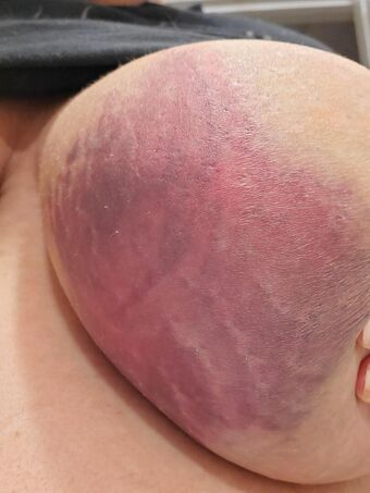 slavadarko / bobasoda