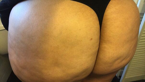 Thicckhloe