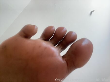 westindies_blackfeet